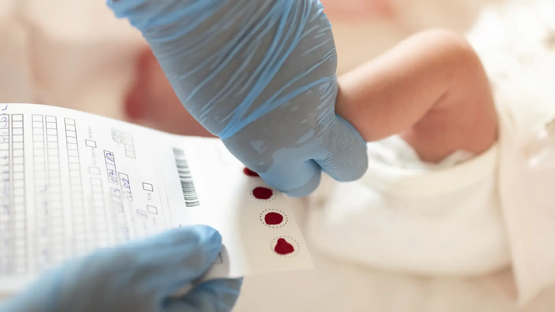 Sağlık Bakanlığı, yeni doğanlarda topuk testi kapsamını 21 hastalığa çıkarıyor